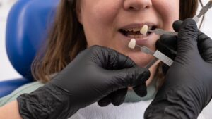Tooth Replacement with Single Tooth Implants or Bridges in Baton Rouge, Louisiana