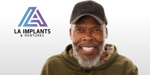 Permanent Fully Functional Full Mouth Implants in Baton Rouge, Louisiana