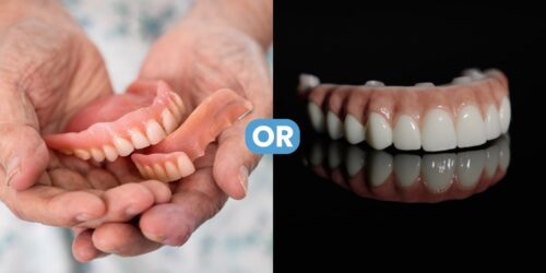 Dental Implants or Dentures: How to Choose The Right Replacement for You