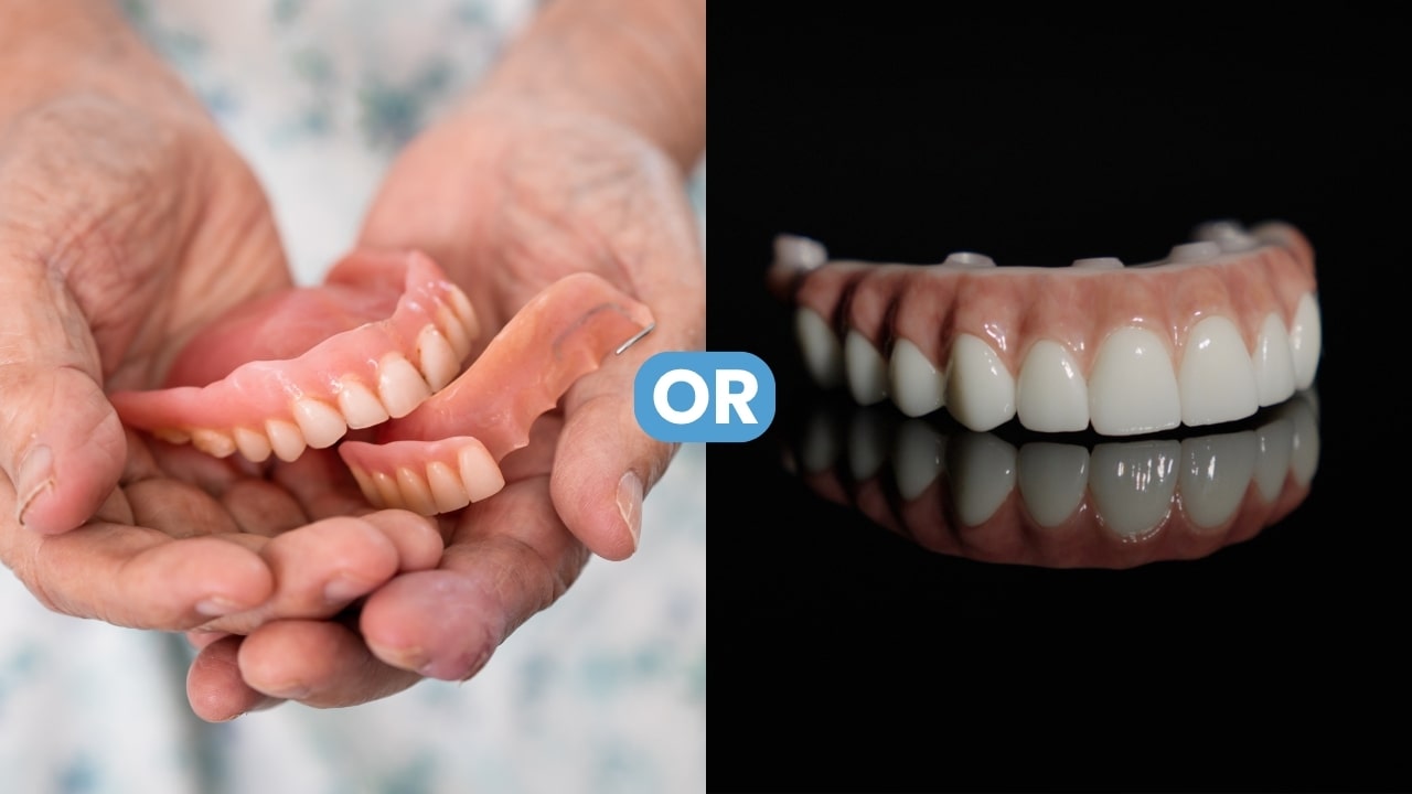 You are currently viewing Dental Implants or Dentures: How to Choose The Right Replacement for You