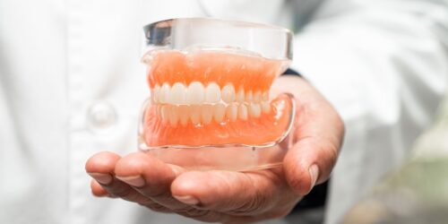 Implant Dentures and Snap-In Dentures Don’t Slip Out