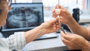 The Beginner’s Guide to Full Mouth Dental Implants
