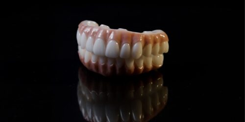 7 Frequently Asked Questions About Dental Implants