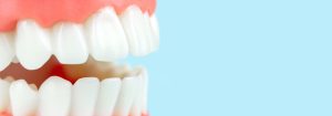 full mouth dental implants in baton rouge