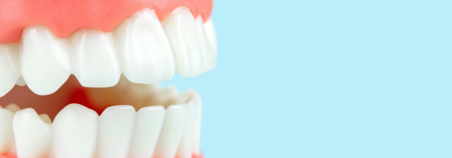 Read more about the article Full Mouth Dental Implant Options in Baton Rouge, LA