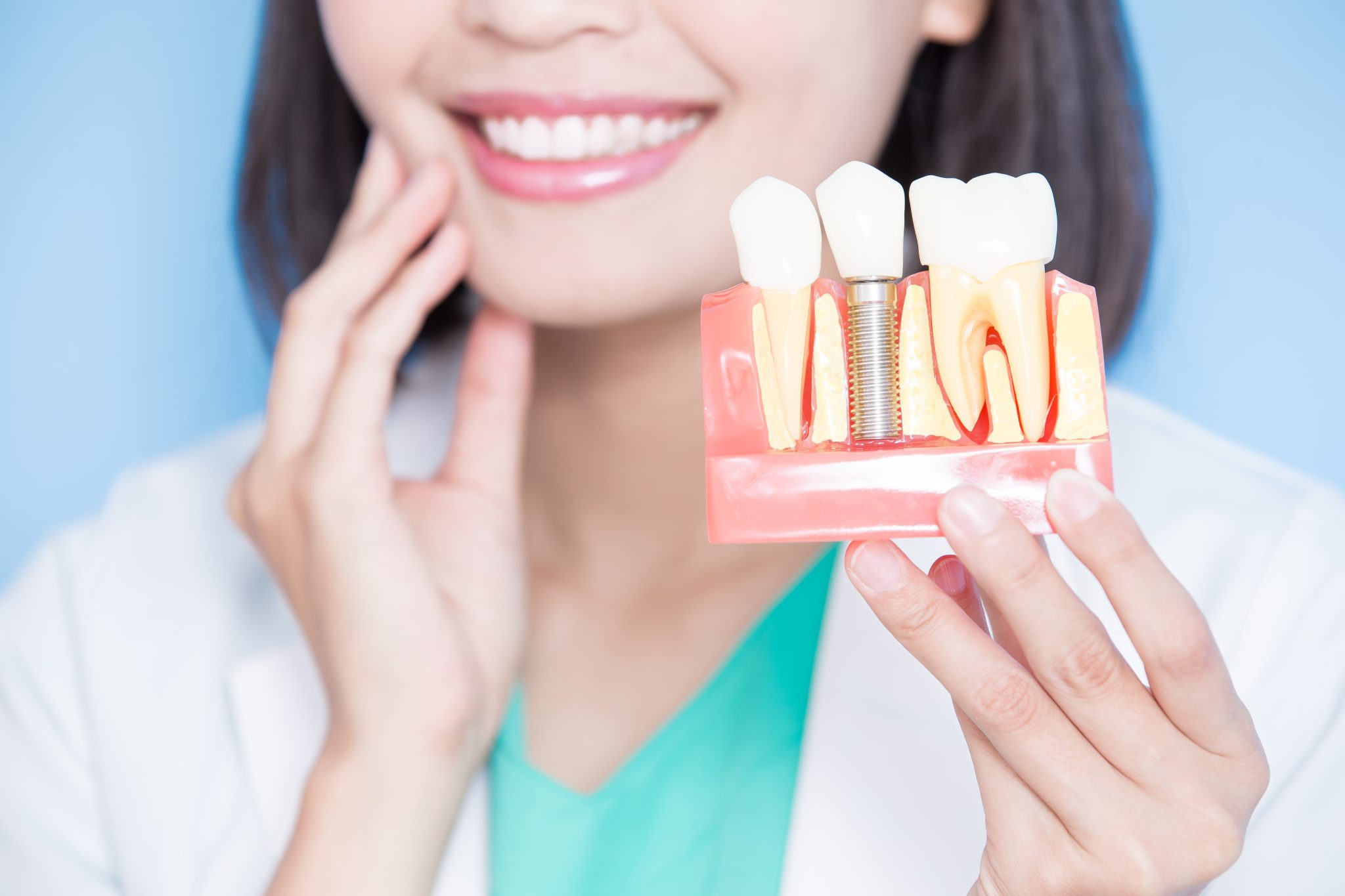 Read more about the article Implant Dentures: A Permanent Solution for Missing Teeth