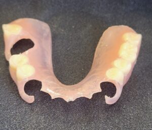 Partial Denture Options