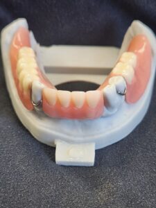 Resin Partial for Back Teeth